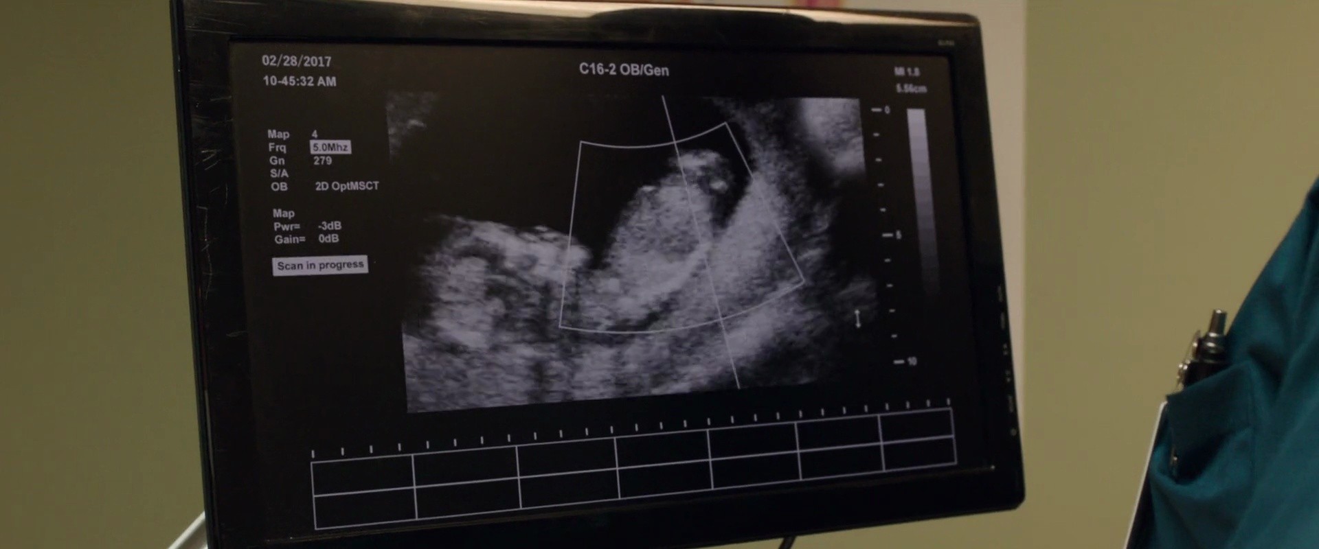 Shot 1135