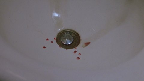 Shot 157