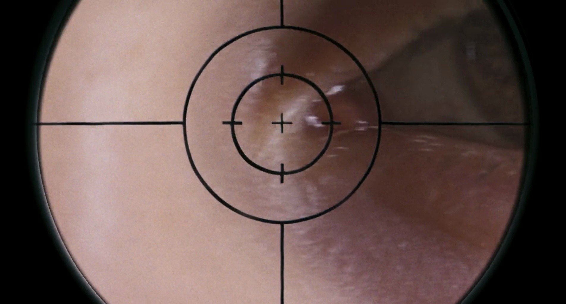 Shot 314