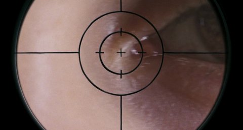 Shot 314