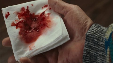 Shot 81