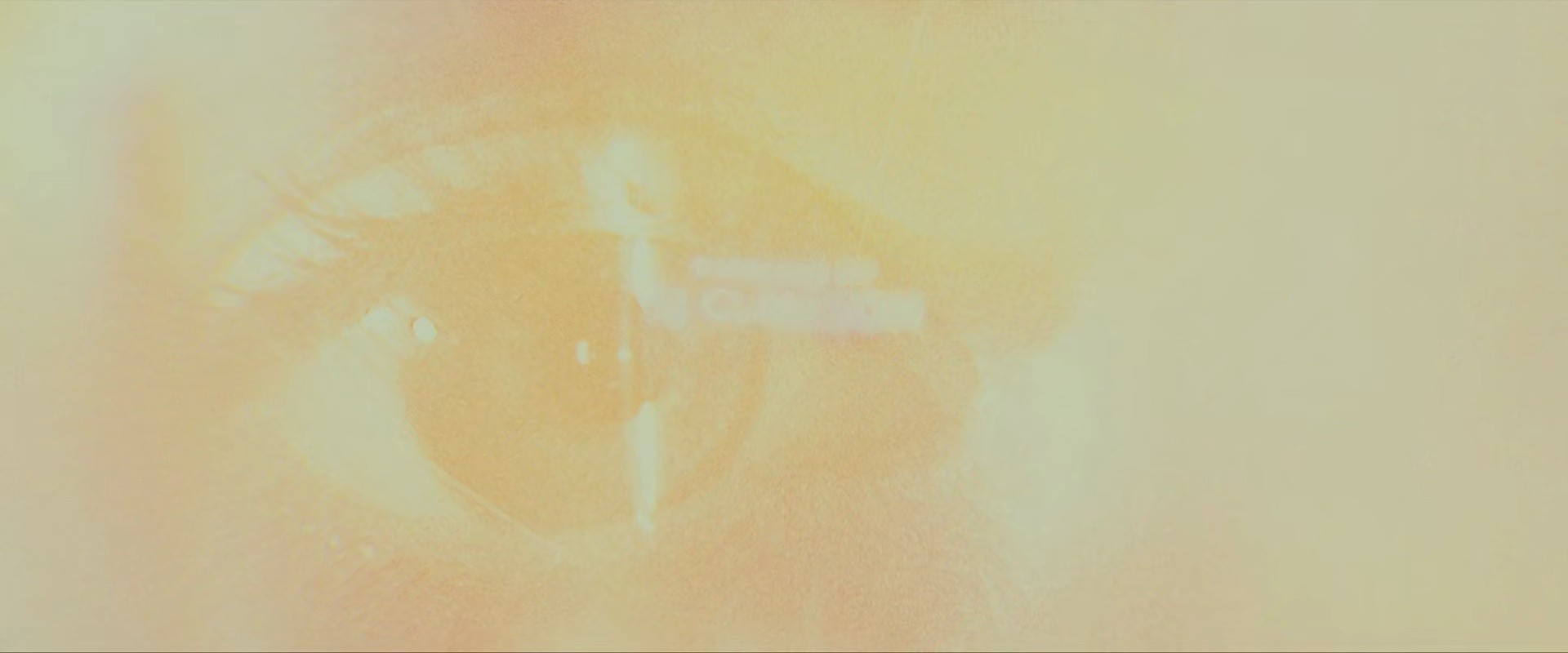 Shot 1971