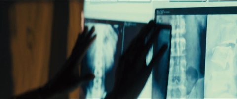 Shot 82