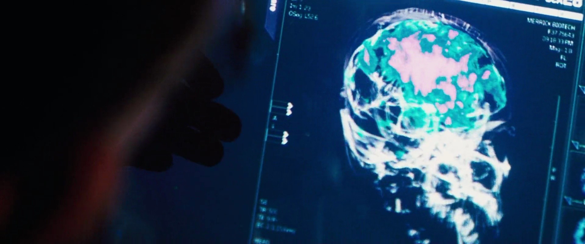 Shot 1987